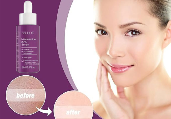 Ορός Niacinamide 20% για Λαμπερή & Καθαρή Επιδερμίδα | Oiloherb