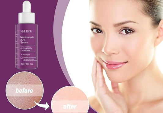 Niacinamide 20% Serum for Bright, Clear Skin | Oiloherb