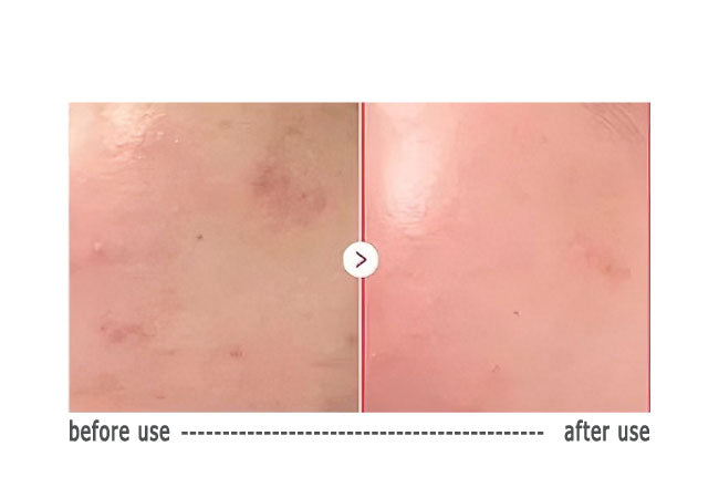 Medicube TXA Niacinamide Serum – Φωτεινή & Ομοιογενής Επιδερμίδα.